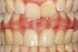 Best dental-activators-cost in Abu Dhabi