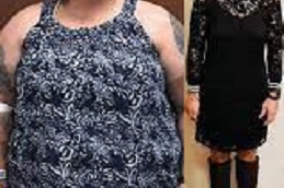 Best gastric-sleeve-procedure Clinic in Dubai