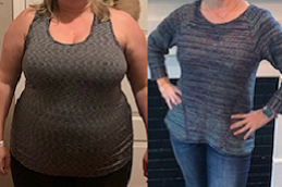 Best gastric-sleeve-procedure in Abu Dhabi