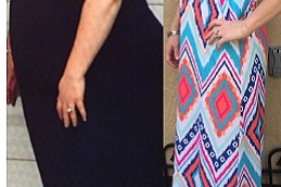 Best gastric-sleeve-procedure in dubai