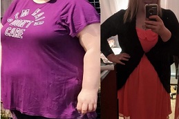 Best mini-gastric-bypass-cost in Abu Dhabi