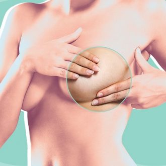 Can Breast Cyst be Removed Without Surgery?