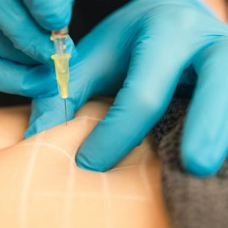 Fat Melting Injections cost Dubai