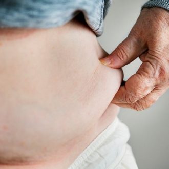 Gastric Sleeve Procedure Pros and Cons in Dubai