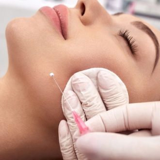 PDO Threads for Jawlines Dubai & Abu Dhabi