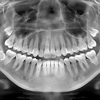 Panoramic Dental X-Ray Cost Dubai & Abu Dhabi