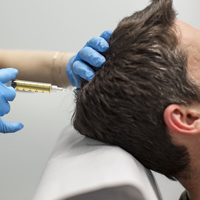 Plasma Hair Treatment in Dubai, Abu Dhabi & Sharjah Royal Clinic