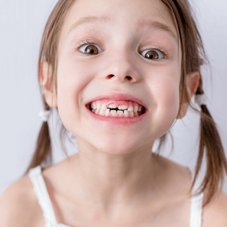 Root Canal Treatment for Kids Dubai & Abu Dhabi