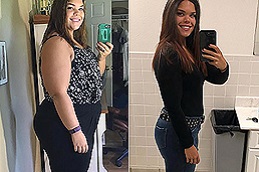 Slimming Surgeries Clinic in Abu Dhabi