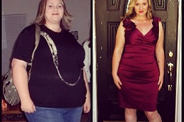 Slimming Surgeries Clinic in dubai & Abu Dhabi