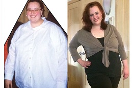 Slimming Surgeries in Dubai