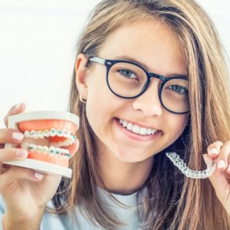 Teeth Braces Cost in Dubai & Abu Dhabi UAE