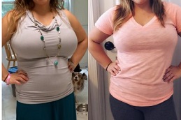 breast-reduction-surgery-cost-2022-with-insuranceClinic in Dubai
