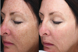 evo-laser Clinic in Dubai