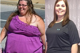gastric-sleeve-procedure Clinic in Dubai