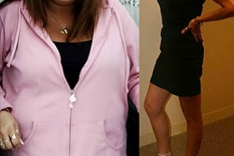 gastric-sleeve-procedure in Abu Dhabi