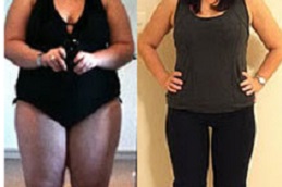 general-surgery in Abu Dhabi