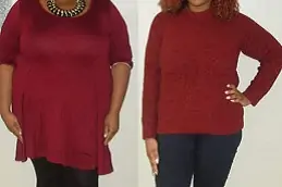 mini-gastric-bypass-cost in dubai