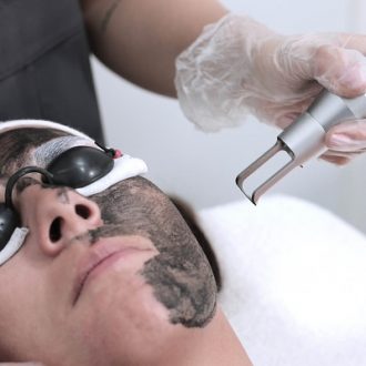 Benefits of Carbon Spectra Laser in Dubai