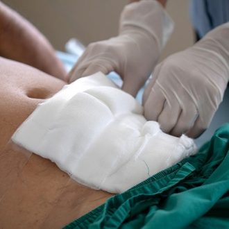 Chronic Wounds Treatment Cost in Dubai