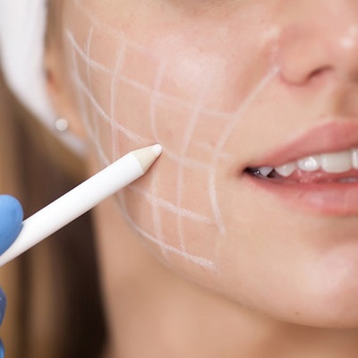 Face Fat Removal Non-Surgical Near You