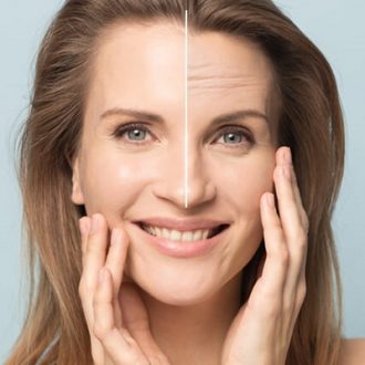 Forehead Lift Cost in Dubai & Abu Dhabi