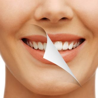 How Does Digital Smile Design Work in Dubai