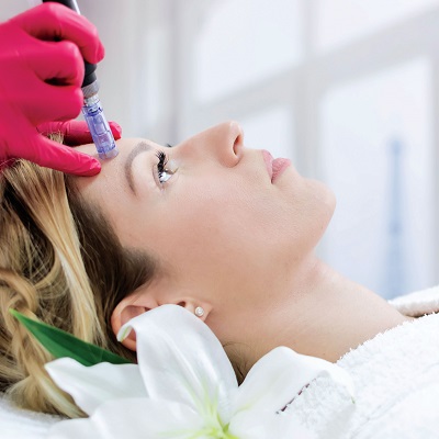 Is Microneedling Permanent for Acne Scars in Dubai