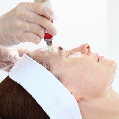 Mesotherapy for Face Treatment in Dubai