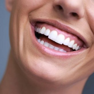 Pros and Cons of Hollywood Smile Dubai
