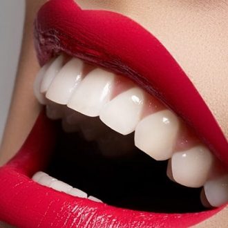 Teeth Whitening Pros and Cons in Dubai