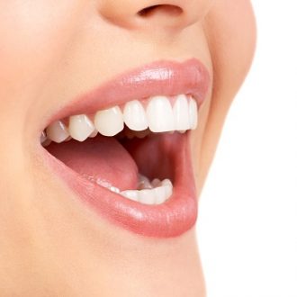 What Are The Benefits of Dental Veneers in Dubai?