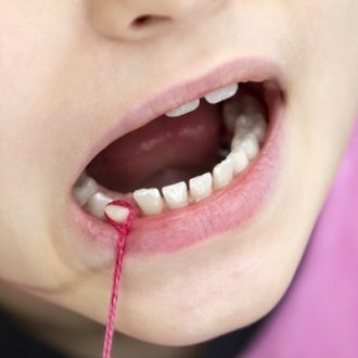 What is the Price of Surgical Tooth Removal in Dubai?