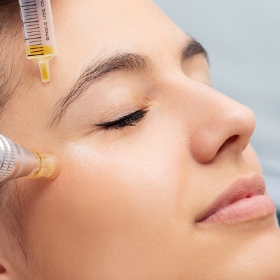 Benefits of Microneedling With PRP In Dubai & Abu Dhabi Cost