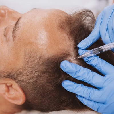 Is PRP Covered By Insurance In The UAE PRP in Dubai Cost & Price