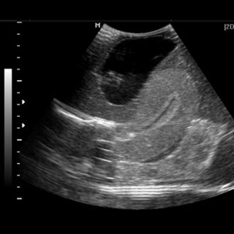 Pelvic Ultrasound for Pregnant Women in Dubai