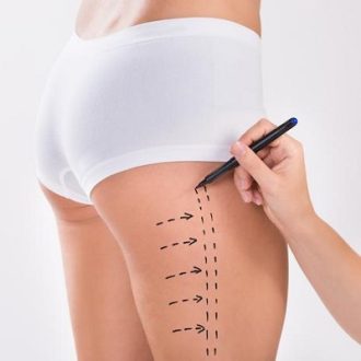 The Benefits of a Thigh Lift in Dubai & Abu Dhabi
