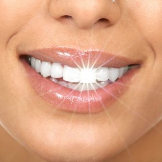 Why People Choose the Hollywood Smile Design