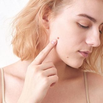 Face Mole Removal in Dubai & Abu Dhabi