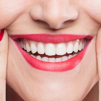 Everything You’ve Ever Wanted to Know About Hollywood Smile in Dubai