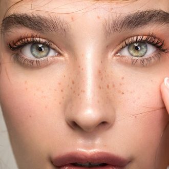 How to Get Rid of Freckles Permanently in Dubai