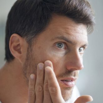 Melasma Treatment for Males in Dubai & Abu Dhabi