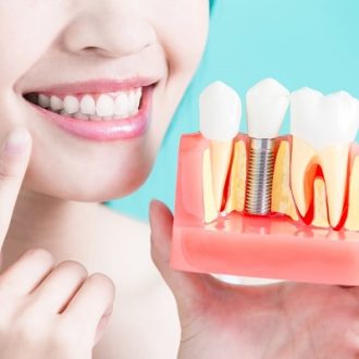 Restore Your Smile and Confidence with Dental Implant