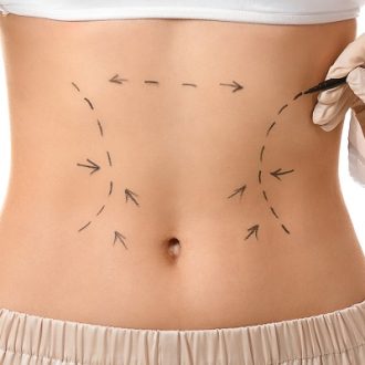 Does Laser Lipo Get Rid Of Belly Fat in Dubai?