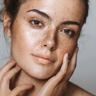 Does Pigmentation Come Back After Laser