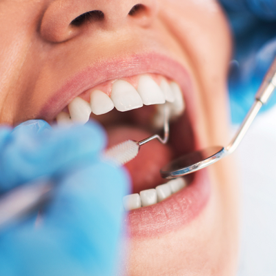 How Do Dentists Clean Toddler's Teeth in Dubai & Abu Dhabi Cost