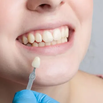 How Do You Fix Protruding Teeth in Dubai?