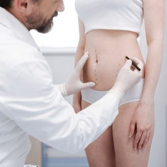 How Long Do Body Jet Liposuction Results Last