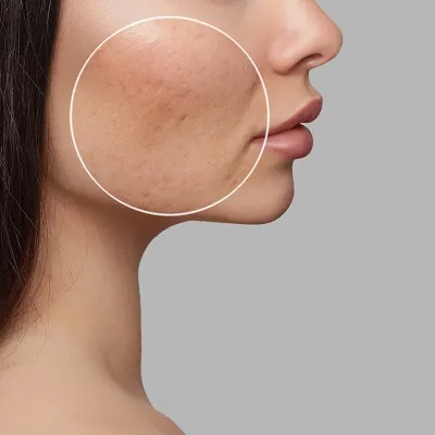 does glutathione lighten skin permanently on face How Long It Take GlutathioneTo The In Dubai Pakistan skincare
