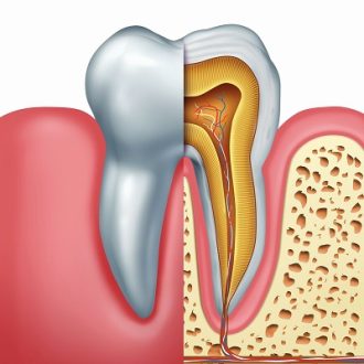 How Long Does Pain After Root Canal Last in Dubai